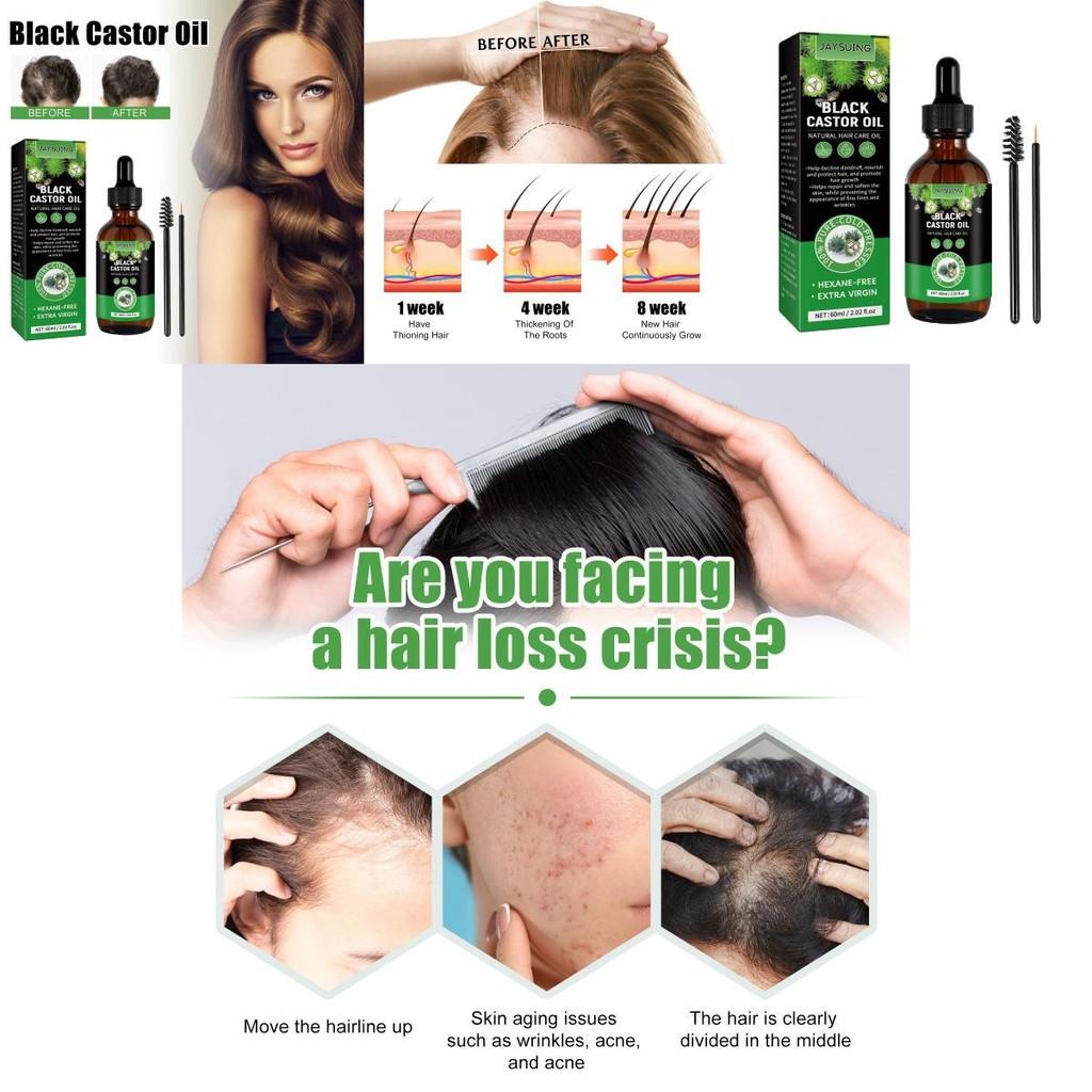 Jaysuing Castor Oil Hair Growth Serum Nourishing Moisturizing Anti Hair Loss 60ml