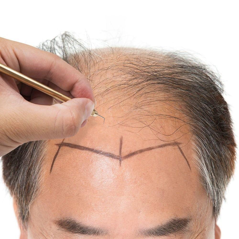 5pcs/set Golden Lace Wig Needles Durable Wig Making Kit Ventilating Needles  Professional