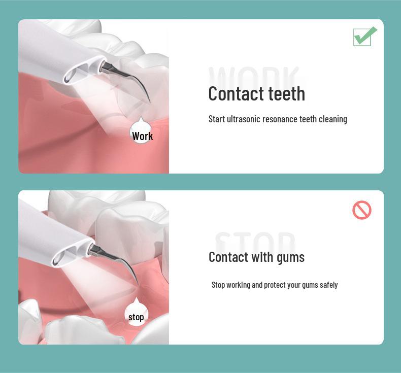 Portable Ultrasonic Tooth Cleaner - Tartar Removal & Whitening Device