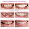 The New Simulation Braces Upper Lower Teeth Whitening Silicone Teeth Sticker Dentures