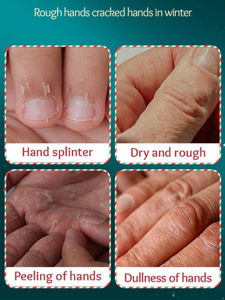 Vánoční sváteční dárková sada krémů na ruce 20 ks cestovních velikostí vonící hydratační mléko pro péči o suché popraskané ruce