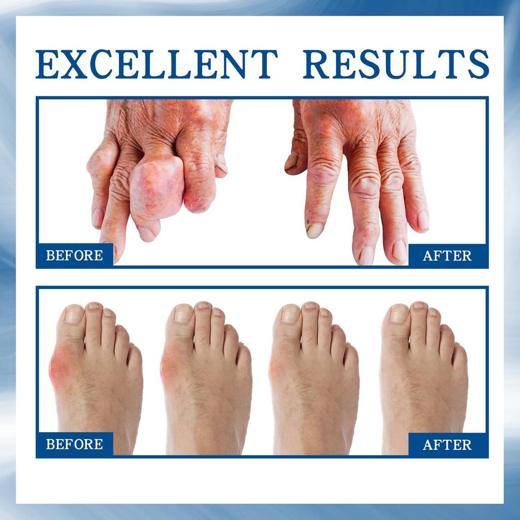 South Moon Joint Care Roll-On Liquid for Body Joints, Wrists, Knees, Lumbar and Cervical Spine Pain Relief Liquid