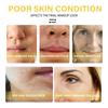 24K Oro Rimuovere La Crema Antirughe Rassodante Anti Invecchiamento Lifting Crema Per Il Viso Dissolvenza Linea Sottile Rughe Sbiancamento Illuminare La Cura Della Pelle Del Viso