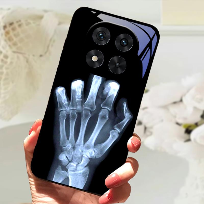 

Загартоване Скляне Чохол Для Poco X7 / X7 Pro Милий Тваринний Жорсткий Полікарбонатний Скляний Чохол Для Телефона Для Xiaomi Poco X5 X6 Pro Ударостійкий Бампер Чохли Poco X5
