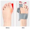 1pc Breathable Hallux Valgus Splint Orthopedic Toe Alignment Bunion Corrector Anti-slip Heel Strap for Left & Right Toe Separator