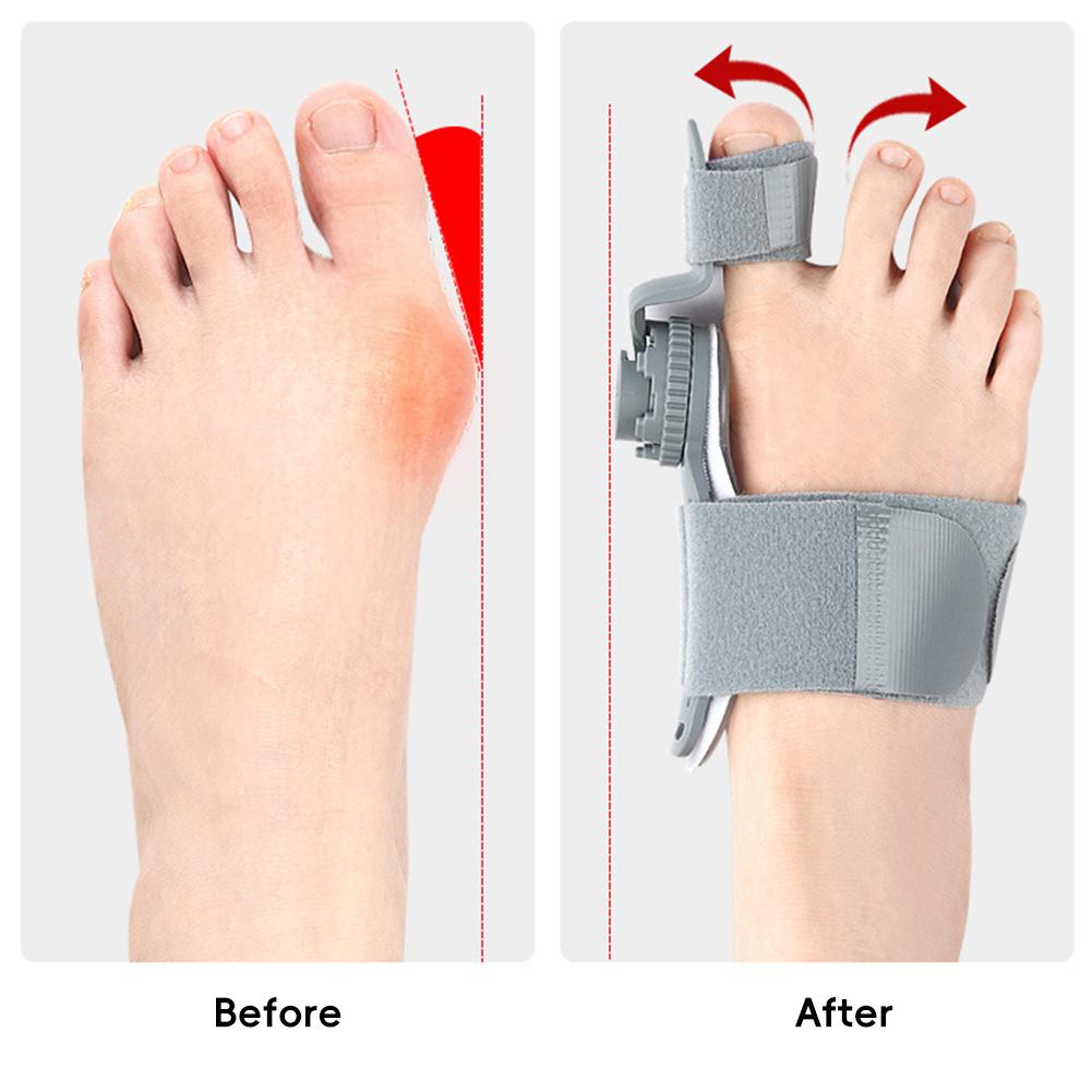1pc Breathable Hallux Valgus Splint Orthopedic Toe Alignment Bunion Corrector Anti-slip Heel Strap for Left & Right Toe Separator