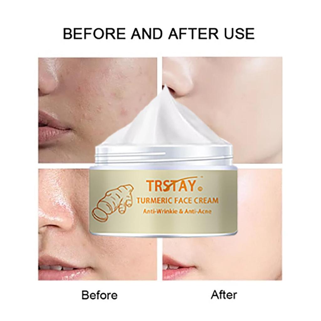 Facial Dark Spots, Dark Spot Correction Creams, Serums, Rich Skin Care, Targeting All Skin Tones, Skin Blemishes, Wrinkles
