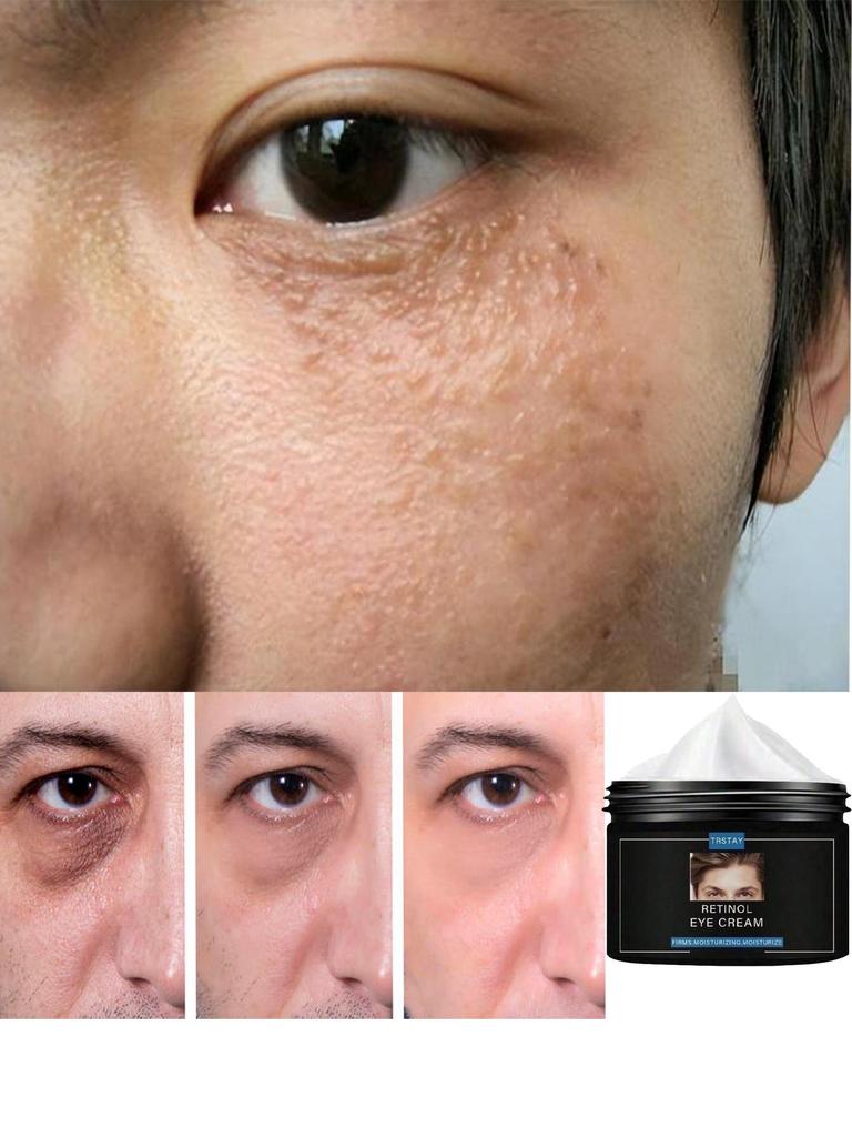 TRSTAY vysoce hydratační krém na obličej hydratační, zvlhčující, opravující, zklidňující pleťové mléko