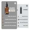 Rosemarypromotes Hair Growth And Strengthens Hair Care Essentialoil 30ml