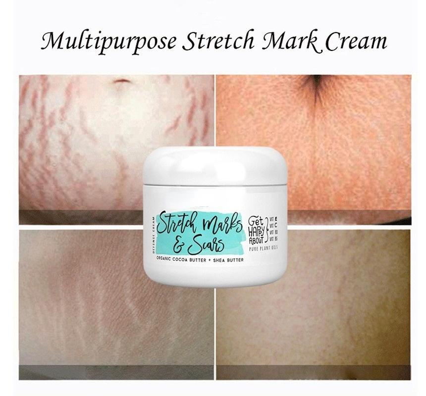 Natural Organic Postpartum Stretch Mark Removal Skin Repair Cream Body Pregnancy Scar  Cream For Women