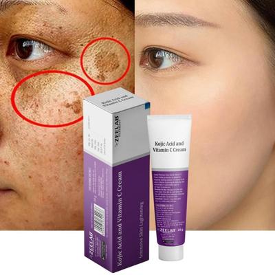 Kojic Acid 2% and Vitamin C Cream 20g | Advanced Formula for Pigmentation, Dark Spots, Age Spots, Acne Marks, & Uneven Skin Tone
