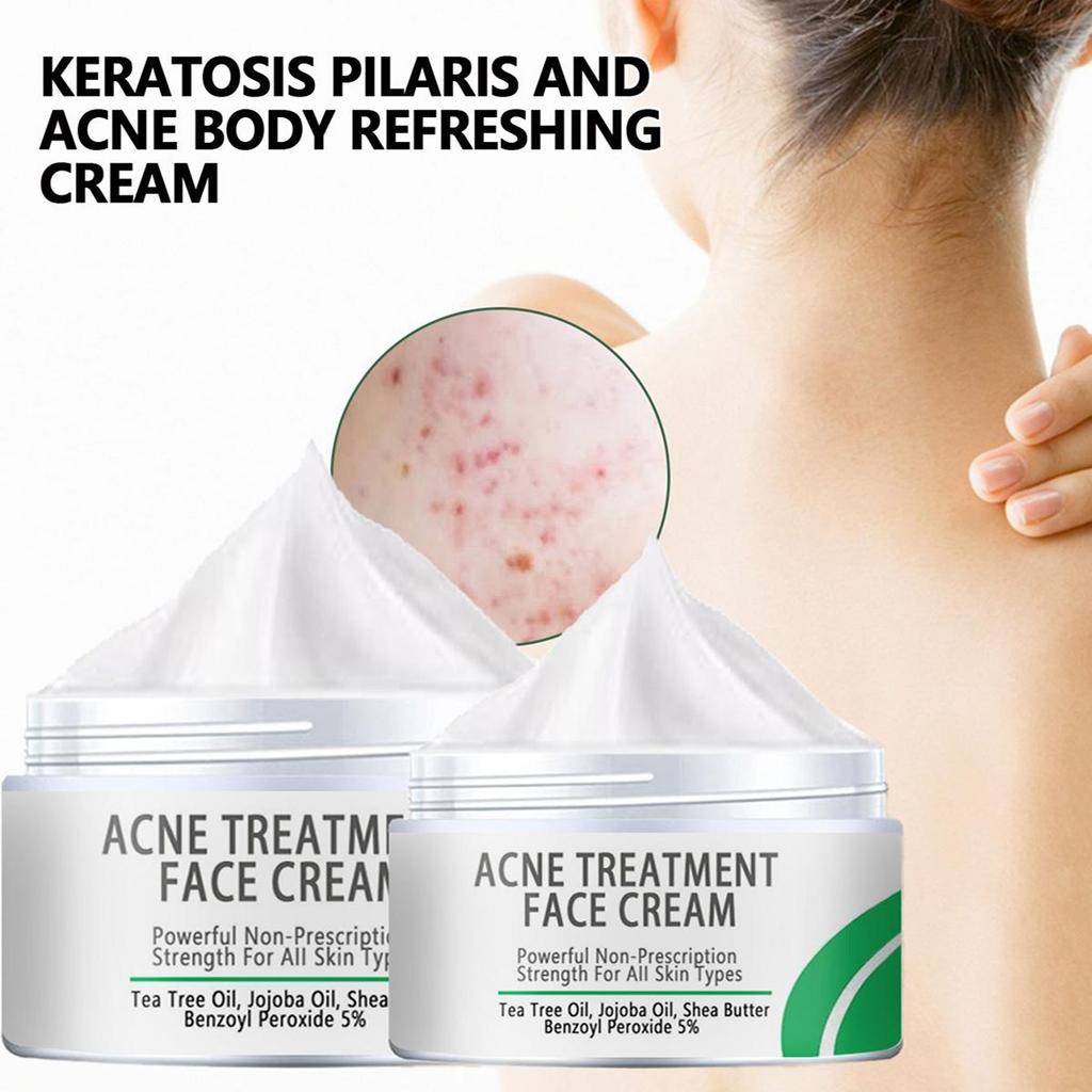 Whitening Skin Oil Control Cover Pores Acne Skin Whitening Cream