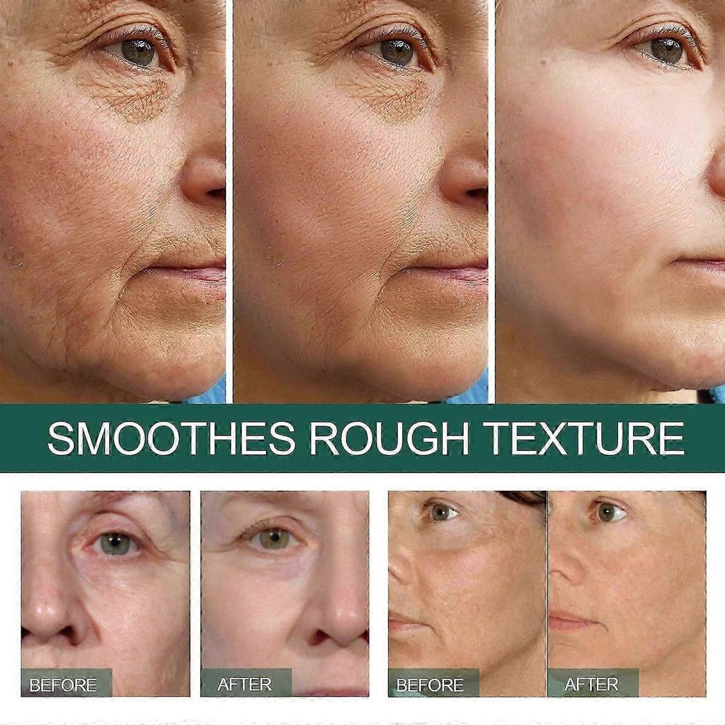 Deep Anti-Wrinkle Serum - Reduce Fine Lines, Dark Circles & Tighten Skin - 30ml