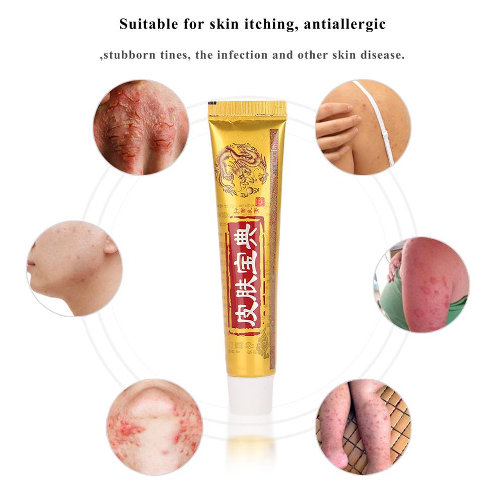 Chinese Original Body Medicine Cream Treatment For Skin Disease
