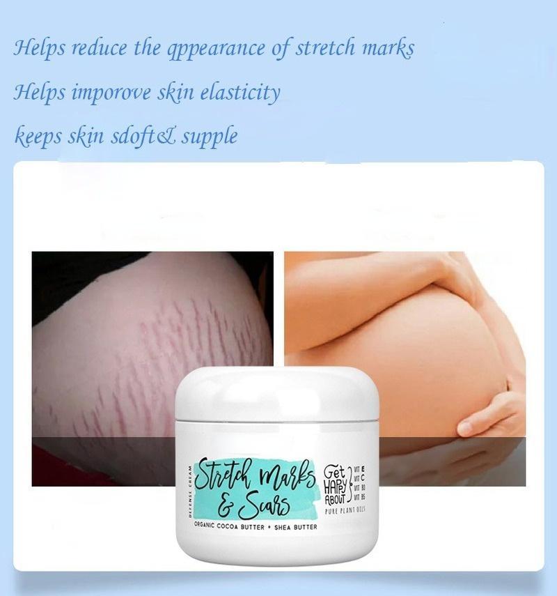 Natural Organic Postpartum Stretch Mark Removal Skin Repair Cream Body Pregnancy Scar  Cream For Women