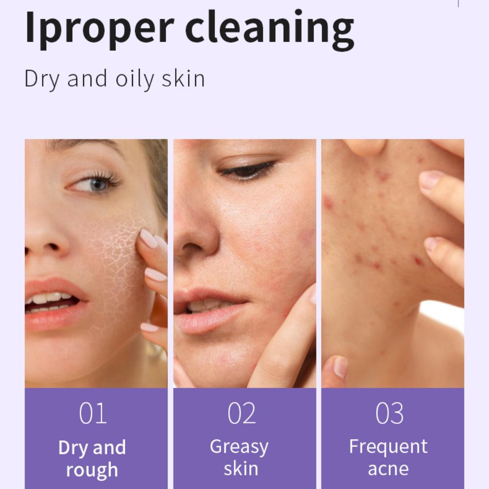 Natural Perilla Bamboo Charcoal Cleansing Gel Moisturizing Oil Control Shrink Pore Remove Blackhead Treatment Acne Cream Whitening Facial Skin Care