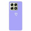 6.67" For Xiaomi 14T Pro 5G Phone Case Clear Silicone Soft TPU Back Cover Case For Xiaomi 14T Pro Case 14 T 14TPro Protective