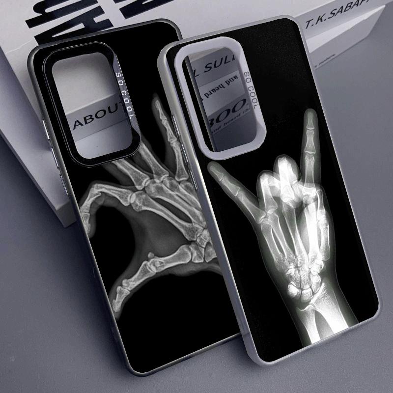Funny X-Ray Hand Bones Shockproof Phone Case for Samsung A17 A16 A15 A14 A37 A57 A36 A56 A26 A35 A55 A25 A34 A54 A24 A13 A23 A33