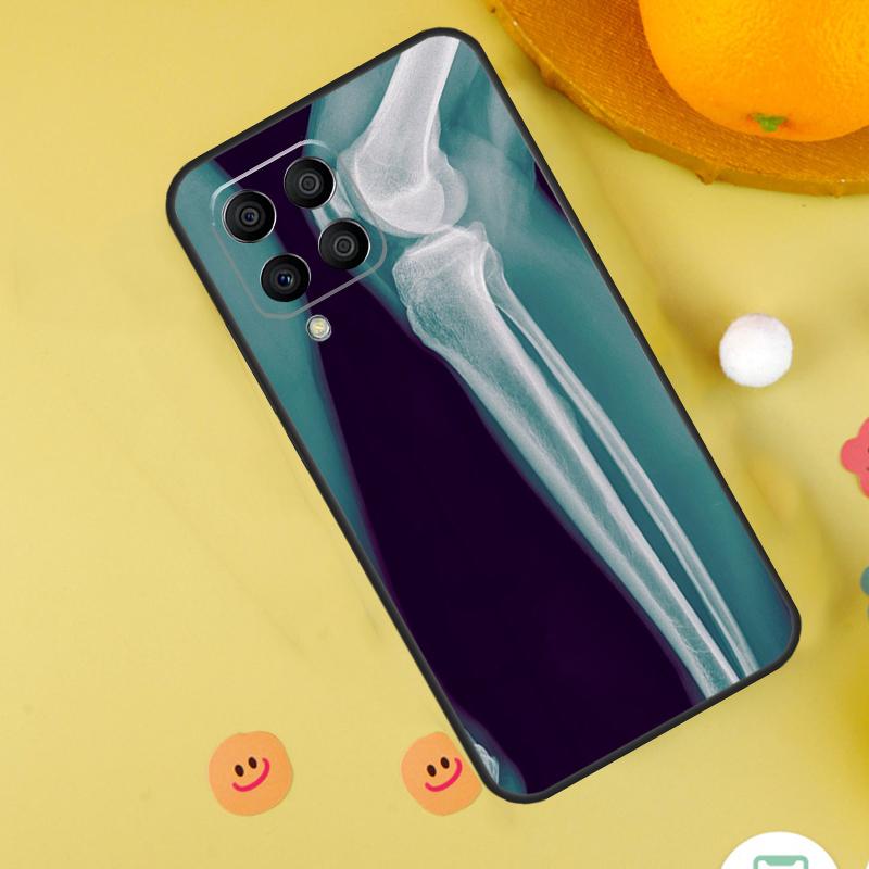 X-Ray Human Anatomy For Samsung Galaxy M54 M34 M14 M12 M32 M52 M53 M33 M13 M20 M21 M51 M15 M55 M31s M30s Case