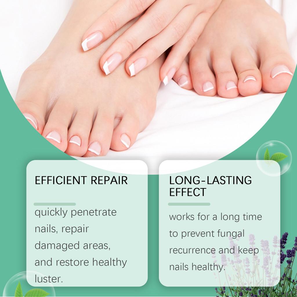 Sanfter Feuchtigkeitsspendender Nagelreparaturstift Für Dicke Und Weiche Nägel Behandlung 4ml