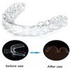 2-10pcs Silicone Mouth Guard Teeth Protector Anti Snoring Soft Guard Mouth Tray for Bruxism Grinding Teeth Whitening Protection 3