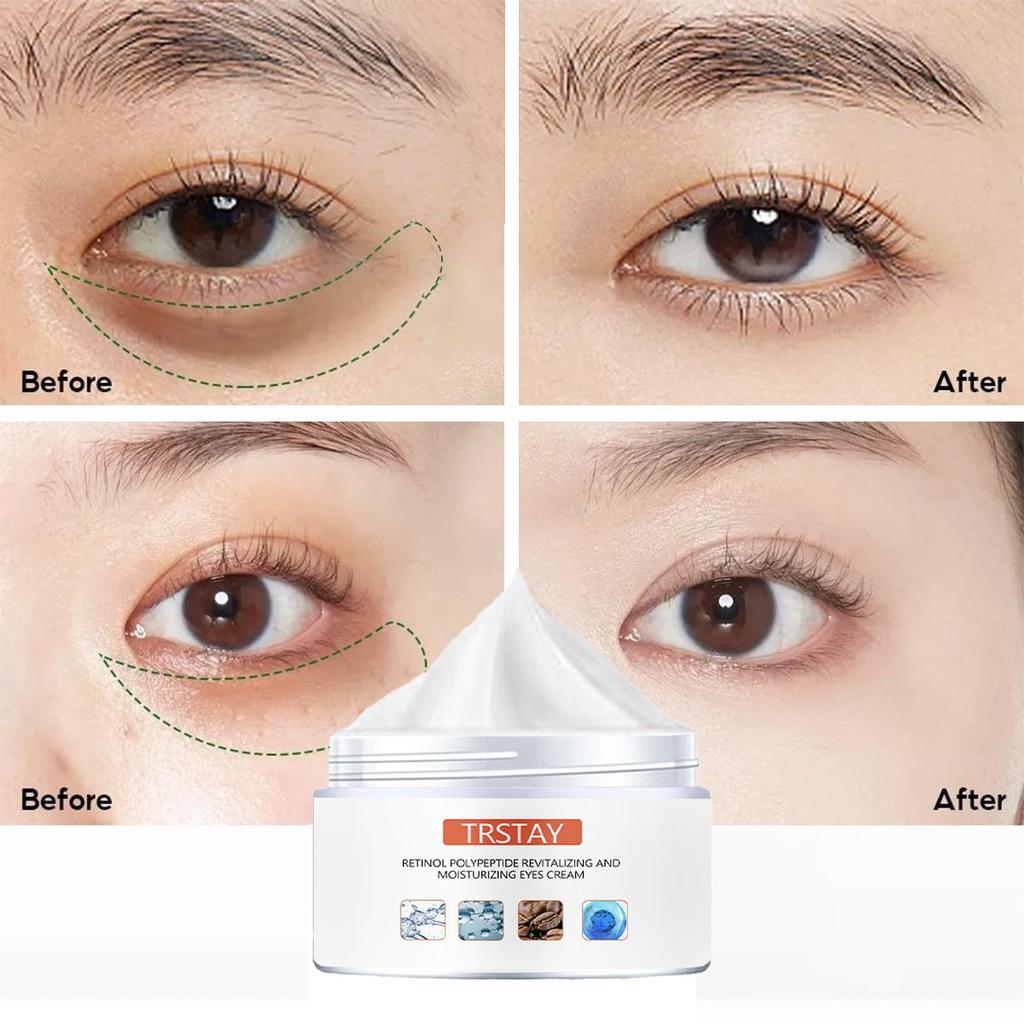 Intensive Eye Cream For Wrinkle Reduction And Deep Moisturization