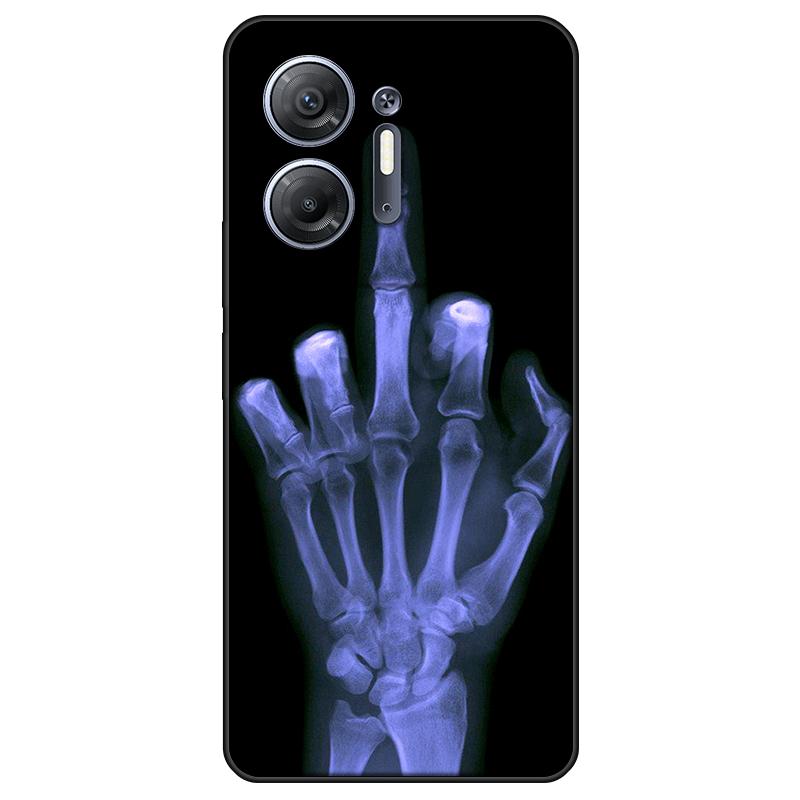 For Infinix Hot 30 5G Casing TPU Painted Back Cover Infinix Hot 30 5G Soft Silicone Case