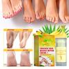 Jaysuing Moisturizing Foot Cream For Deep Hydration And Skin Repair For Cracked Dry Feet
