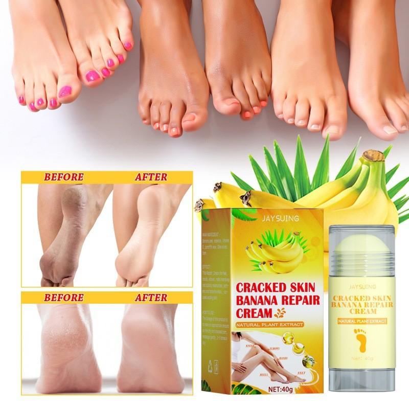Jaysuing Moisturizing Foot Cream For Deep Hydration And Skin Repair For Cracked Dry Feet