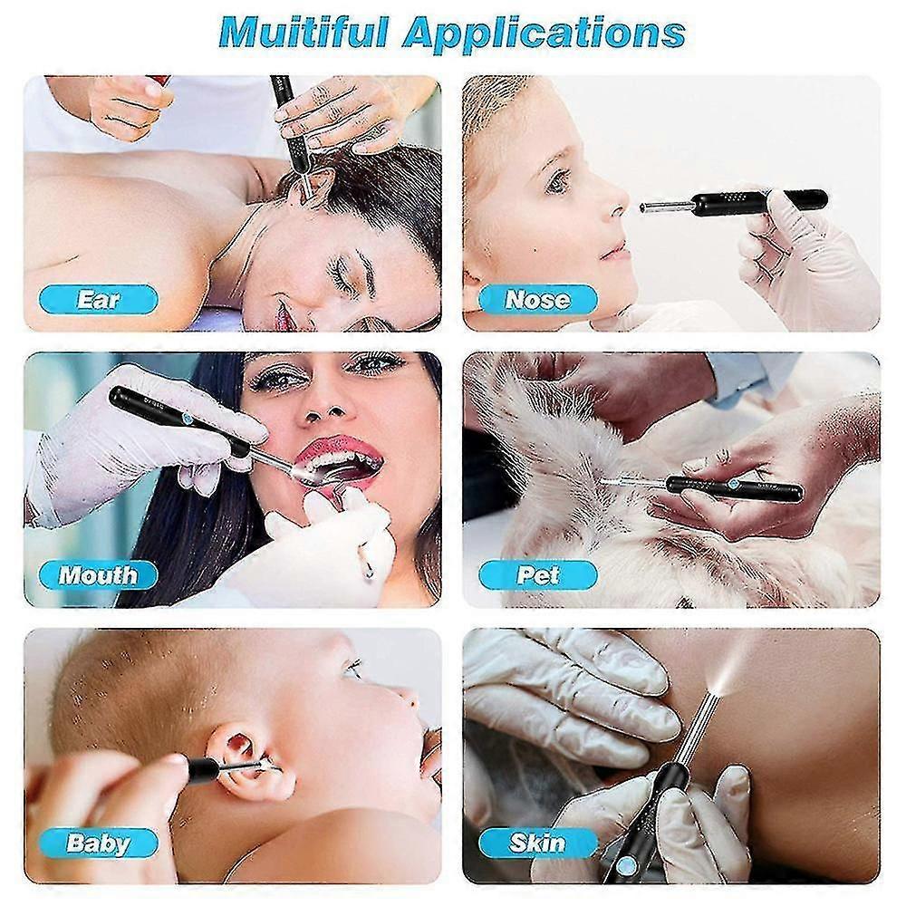 1 Pcs Ear Wax Removal, Ear Cleaner Ear Wax Removal Kit, Wireless Ear Wax Remover Otoscope With Hd Endoscope Ear Camera Ear Wax Removal Tool