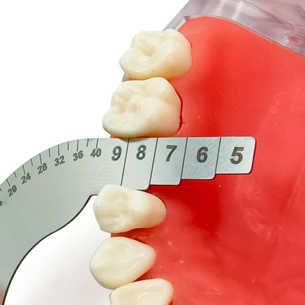 Edelstahl Dentalimplantat Platzbewertungsmessgerät Kieferorthopädisches Lisa-Messgerät zur Vorbereitung der prothetischen Rehabilitation