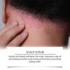 Nourishing Scalp Scrub Shampoo for Dry Hair  Deep Cleansing, Gentle Exfoliation & Intense Moisturization with Turmeric & Avocado Oil for Healthy, Revi