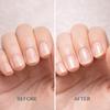 3 Günlük Tırnak Bakım Serumu Sıvısı, 15ml Tırnak Bakım Sıvısı, Tırnakları Besler ve Ölü Deriyi ve Mantarları Azaltır