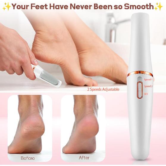 Electric Foot Callus Remover, Callus Remover for Feet Rechargeable Portable Pedicure Tool Kit, Smooth Pedicure Wand for Feet Care, Removes Dry Hard &