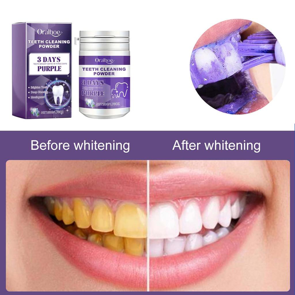 Oralhoe Purple Teeth Cleaning Powder Fresh Breath Tartar Calculus White Teeth Cleaning Scaling Powder Oral Care