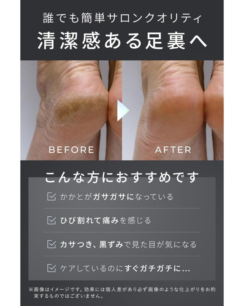 PREMIUM ČERNÝ Odstraňovač mozolů na patách Exfoliační pemza na paty Foot Tsuru Labo [Inspirováno dermatologem] Černý, Hrubý/Jemný Oboustranný pilník, Kámen, Péče,