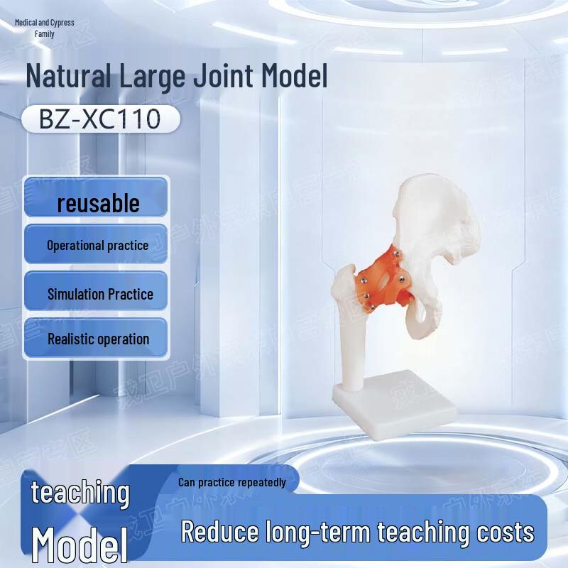 Natural Large Joint Model