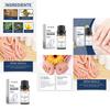 Ouhoe Nourishing Nail Repair Essence For Healthy Strong Clean Nails And Toenails