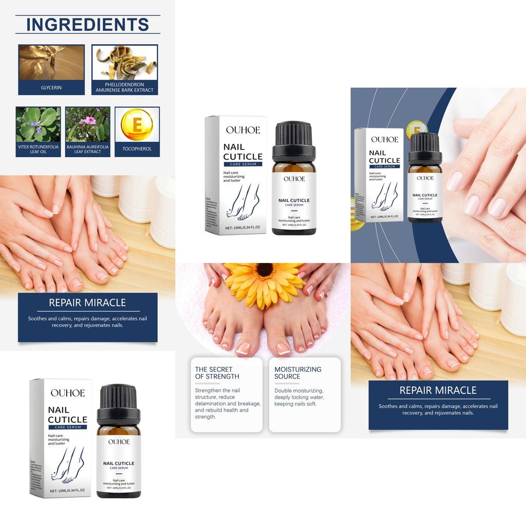 Ouhoe Nourishing Nail Repair Essence For Healthy Strong Clean Nails And Toenails