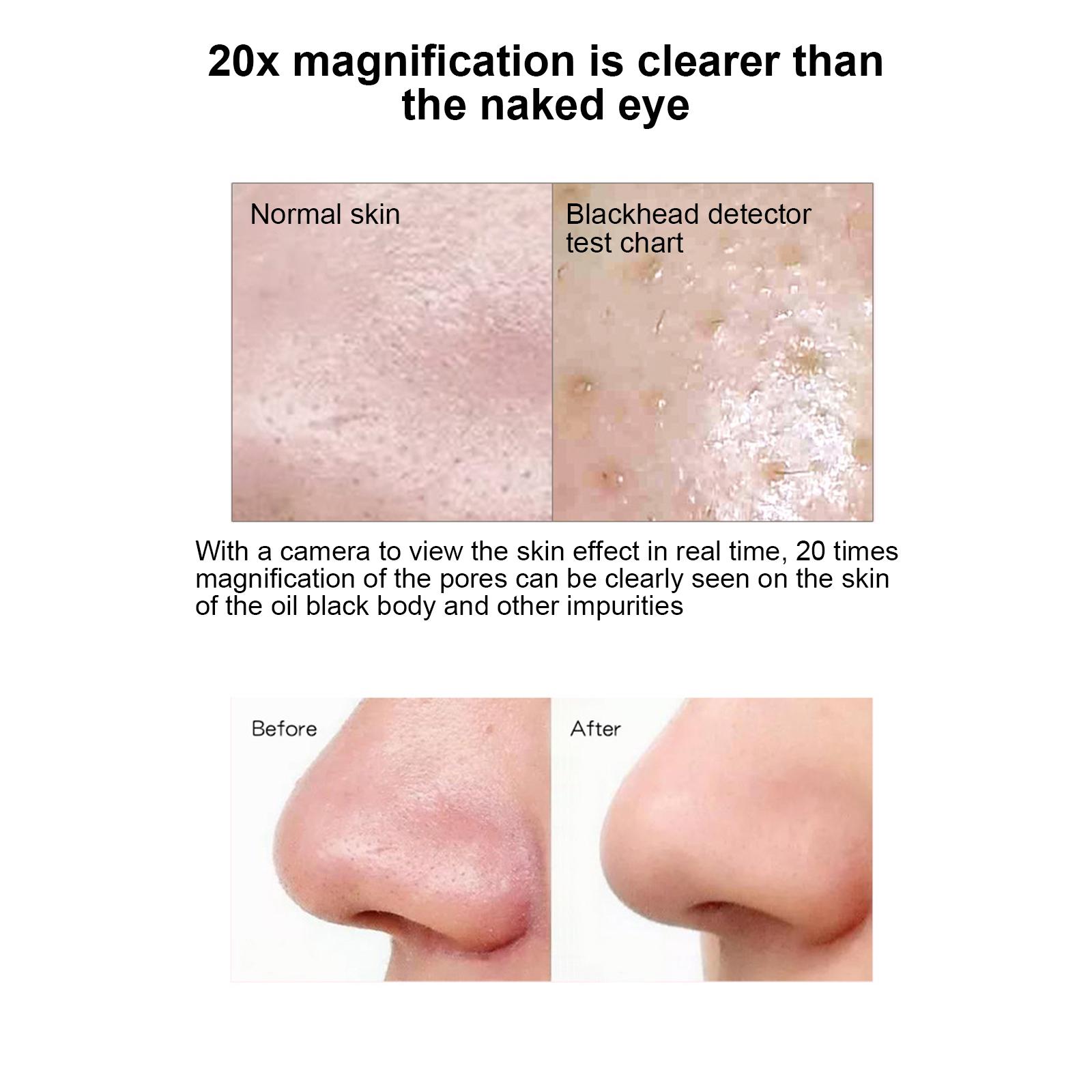 

Electric Blackhead Meter to Remove Blackheads & 200W 6-speed Adjustment Face Cleaning with 4 Suction Heads