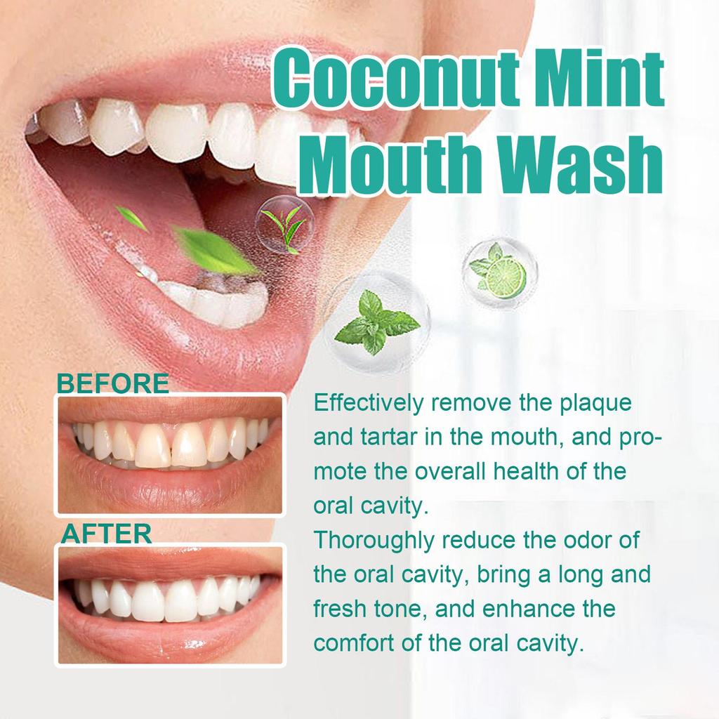 OUHOE Coconut Oil Mouthwash 100ml Remove Tooth Stains Mouth Freshener Protect Your Gums Remove Bad Breath Oral Care Products