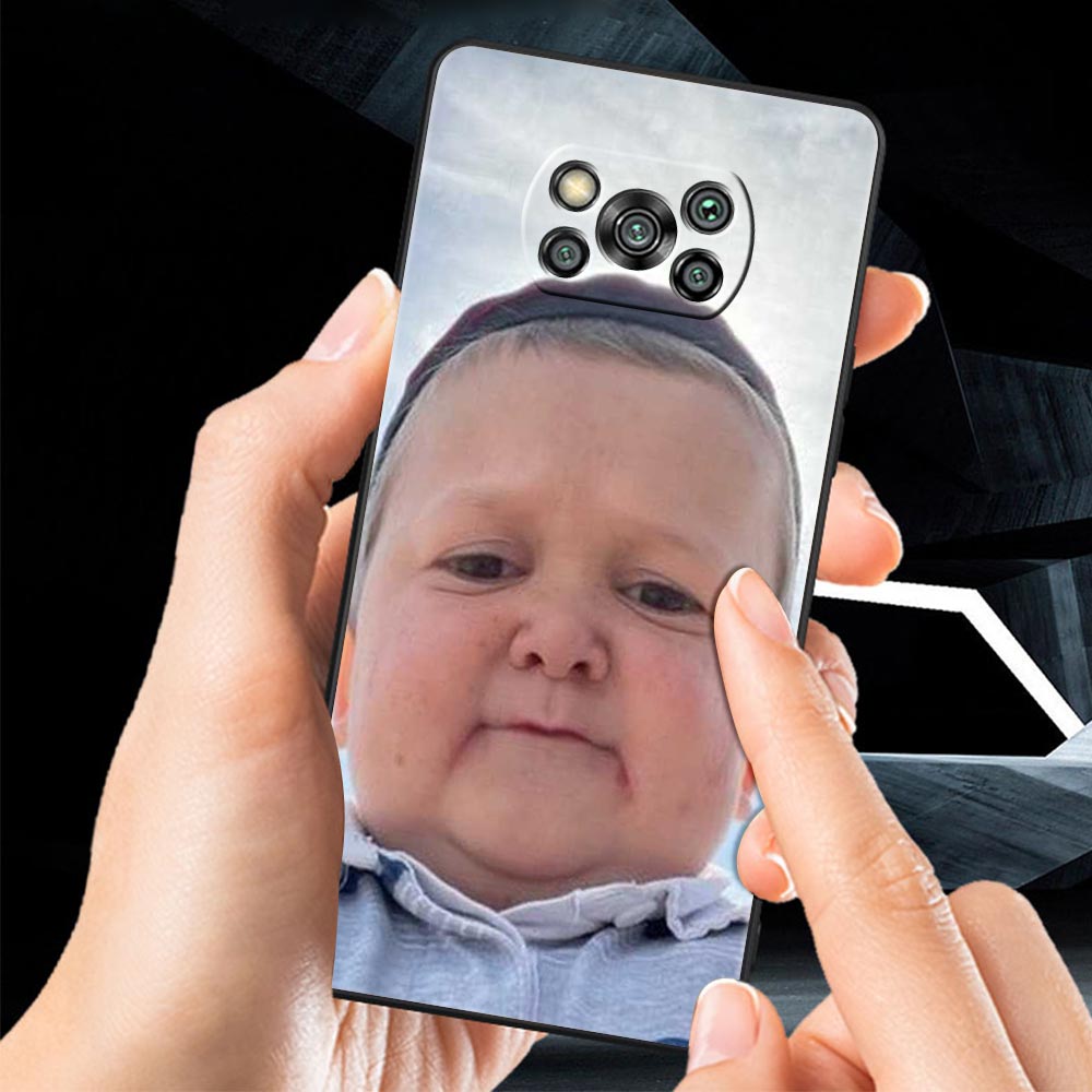 Funny Hasbulla Phone Case For Xiaomi Mi Poco X3 NFC M3 F4 F3 M4 X4 Pro 5G Note 10 12 Lite 11 11T 10T 11X 13 12T Pro 9T Cover