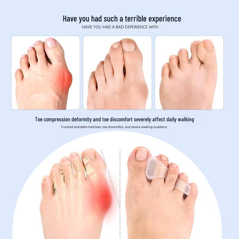Silikon Hallux Valgus Korrigerare: Tå- och hallux valgus-separerare med tre hål för överlappande tår för dag- och nattanvändning