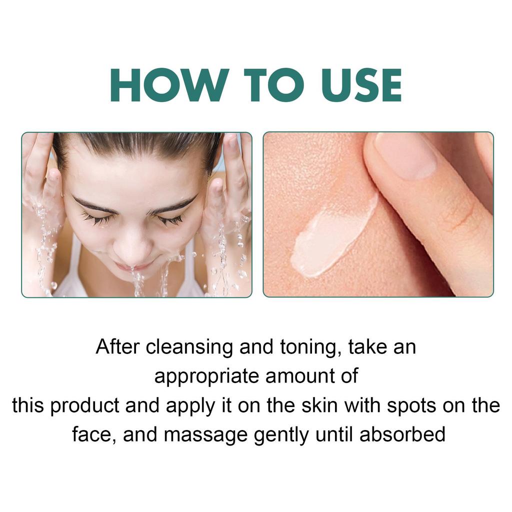 EELHOE Nicotinamid-Sommersprossencreme, feuchtigkeitsspendende Gesichtsaufhellungsreparatur, Hautpflege, Melasma-Entferner, Pigmententfernungscreme, 30 g