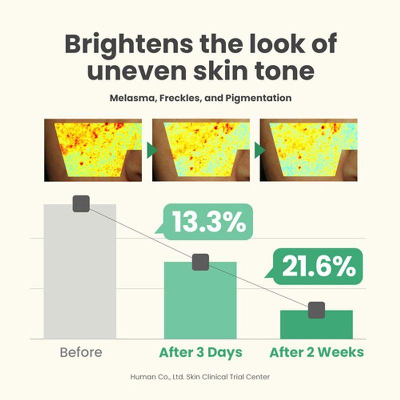 AXIS-Y Dunkle Flecken korrigierendes Glow-Serum 50 ml