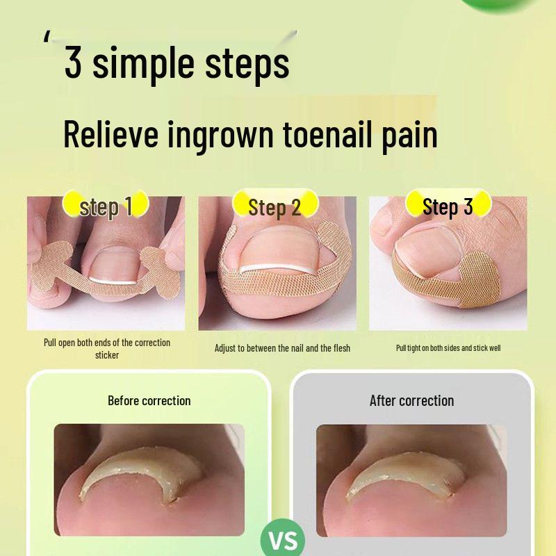 Kleberfreie Natürliche Hühneraugen-Nagelkorrektur-Pflaster Aufkleber
