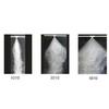 Duza de ceață Echipament de irigare Duza atomizatoare Cap de pulverizare Sistem de răcire prin ceață Duza de ceață din alamă Cap de pulverizare 10 BUC