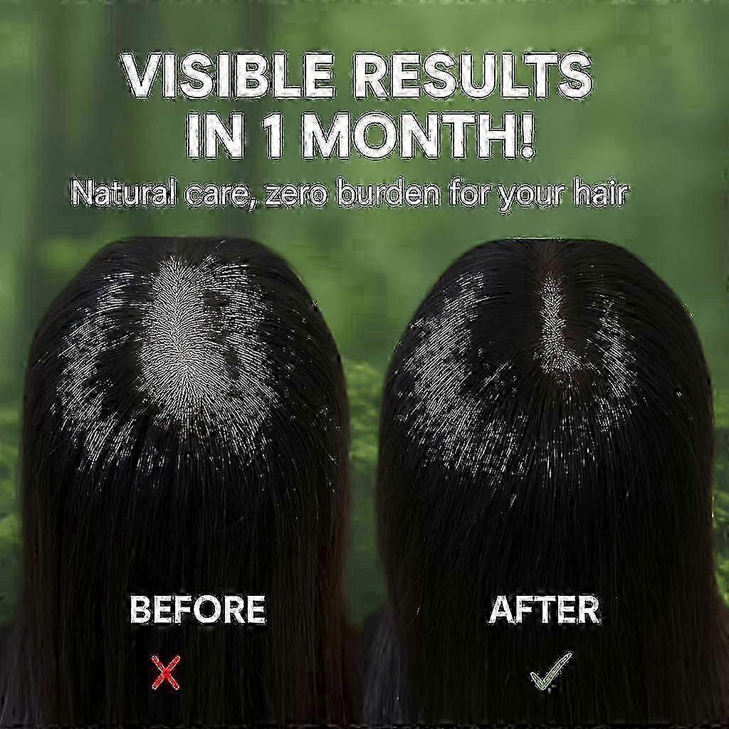 Nature Triangle Shampoo Bar, Nature Seven Green Soep Shampoo Netural Usman Grass Shampoo Bar, Calming & strengthens Hai for Women and Men