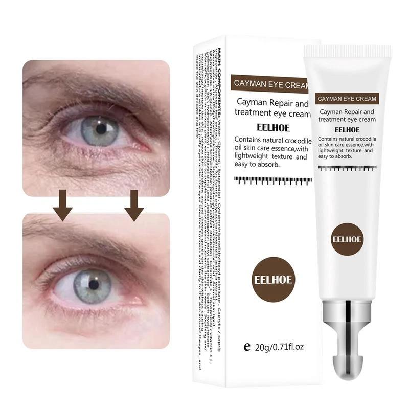 

Антивозрастной крем для глаз, удаление темных кругов, мешков под глазами, сыворотка, улучшение отечности, лифтинг, фирменное отбеливание, увлажняющие средства по уходу за кожей