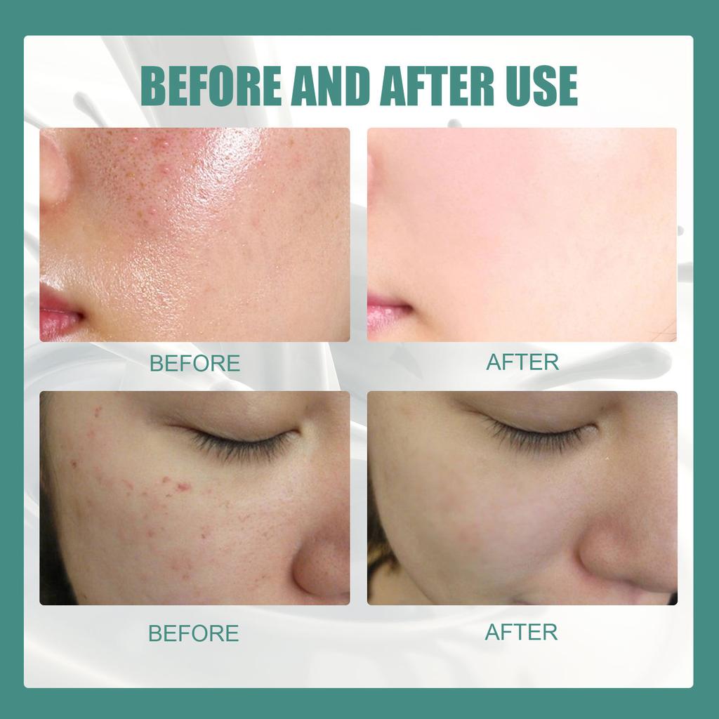 EELHOE Goat Milk Soap Natural Organic Silk Protein Soap Mites Acne Remove Tender White Handmade For Body Facial Deep Cleansing